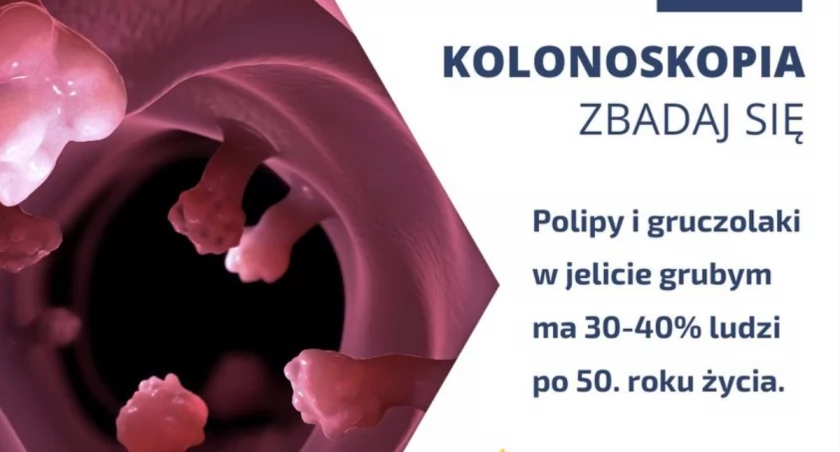 Kolonoskopia zdjęcie via NFZ